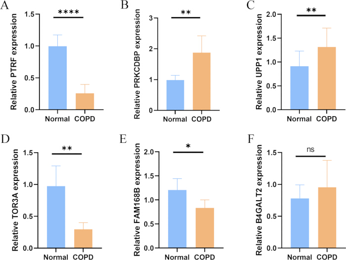 Bar graphs comparing gene expression levels in normal vs COPD samples, statistical significance indicated.
