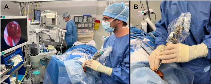 Surgical endoscopy; medical team using endoscopic device for visualizing internal organs in a procedure.