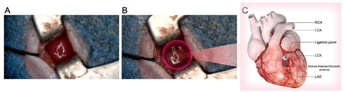 Heart anatomy diagram with ligation point and coronary arteries; images of surgical site.