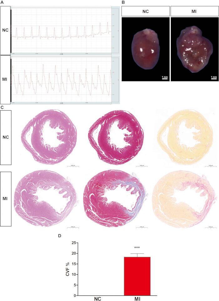 figure-results-1 Cardiac fibrosis analysis: ECG graph, heart tissue images, histological slides, fibrosis quantification chart.