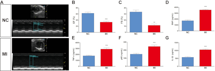 figure-results-2 Cardiac ultrasound images with bar charts; EF, FS, BNP, TNFα, p65, IL-1β levels in NC vs MI groups.