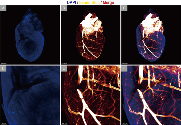 figure-results-3 Heart anatomy fluorescence imaging; DAPI, Evans Blue staining; microscopy, cellular structure analysis.