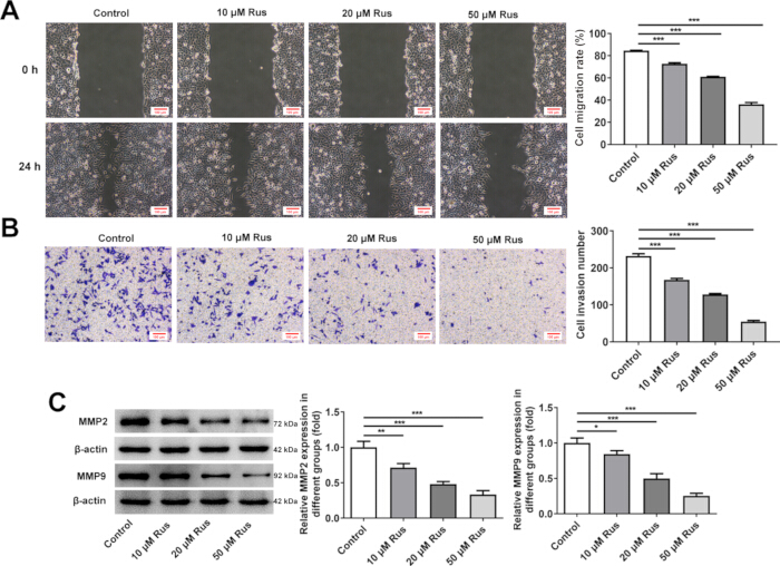 Cell migration and invasion assays; wound healing, transwell analysis with Western blotting for MMP2/MMP9.