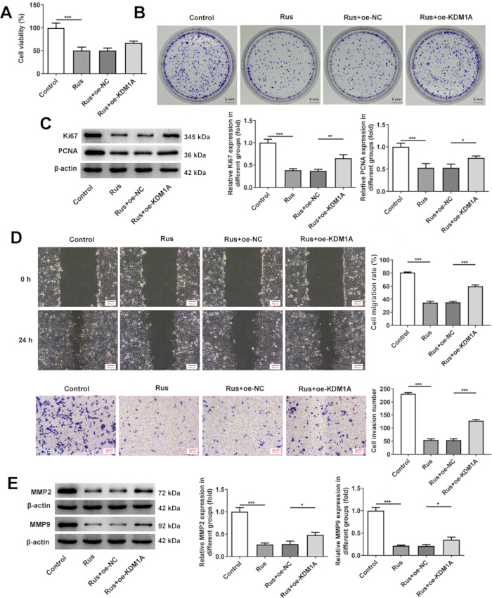 Cell viability, colony formation, protein expression, migration, invasion; graphs, blot, assay results.