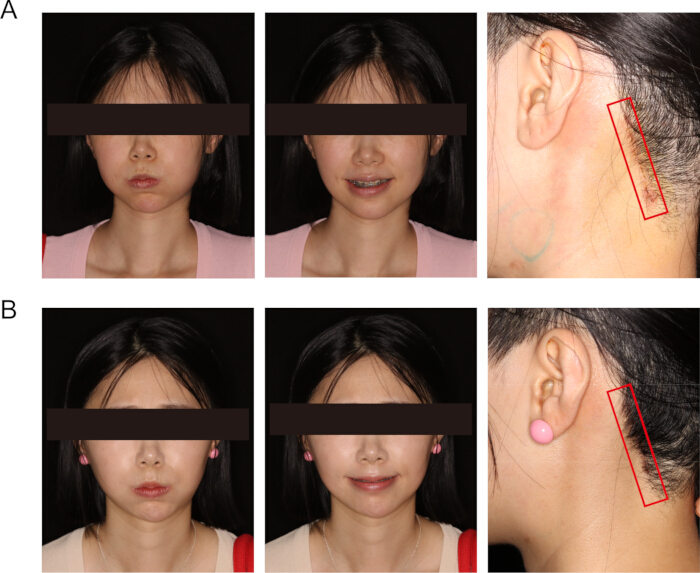 figure-results-3 figure-results-3