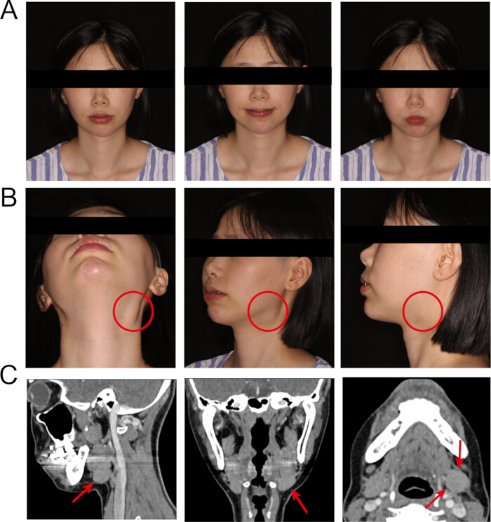 figure-results-4 figure-results-4