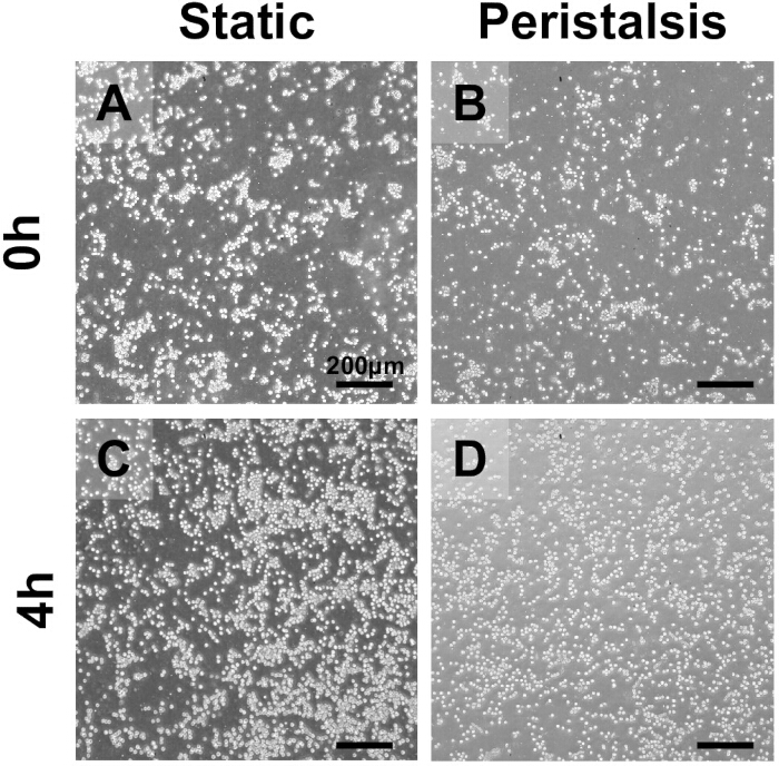 Cell dispersion comparison, static vs. peristalsis, at 0h and 4h; microscope image analysis.