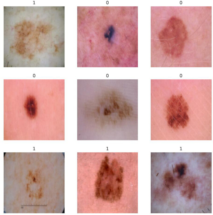 figure-results-6 皮肤病变分析,黑色素瘤分类;诊断图像,皮肤镜检查结果。