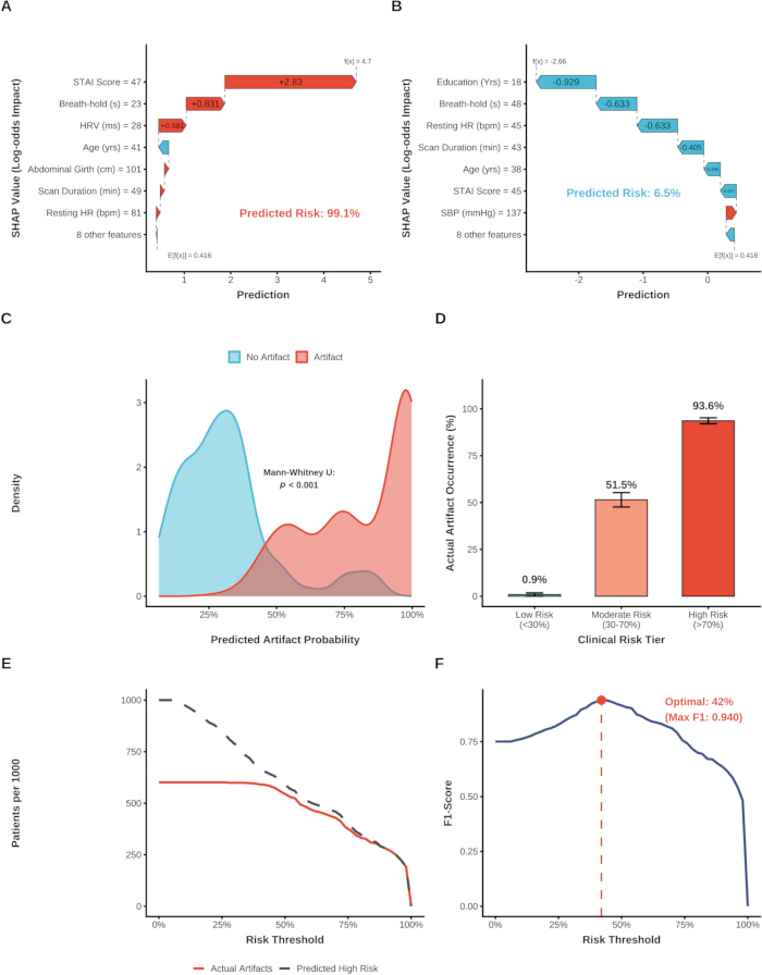 figure-results-5 SHAP analysis bar charts predicting risk, density plot for artifact probability, clinical risk comparison.