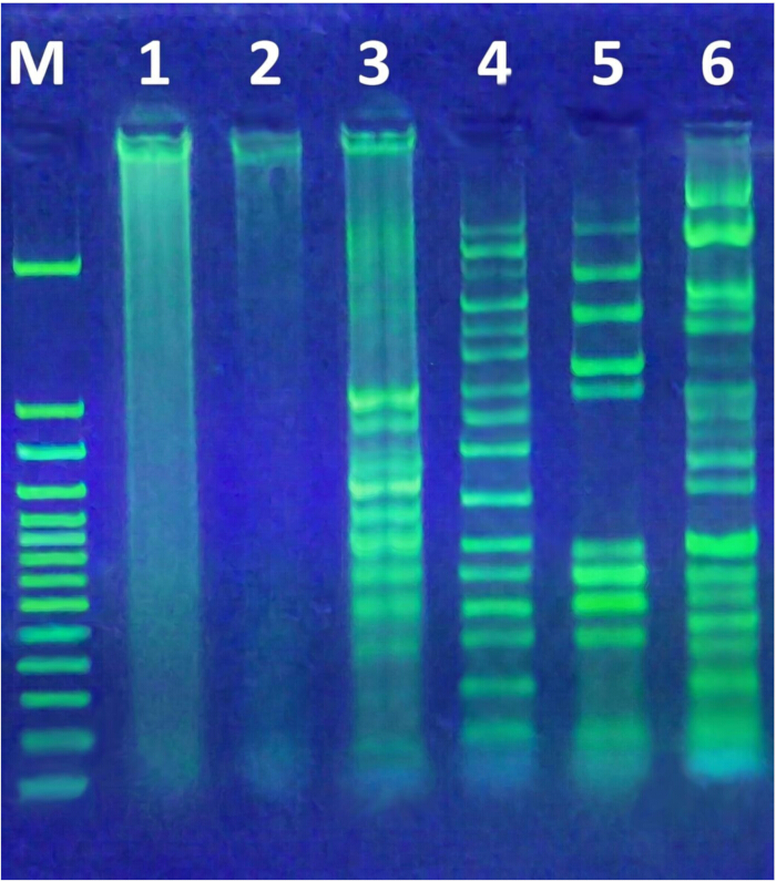 DNA electrophoresis gel, six samples, ladder marker, displaying band separation for analysis.