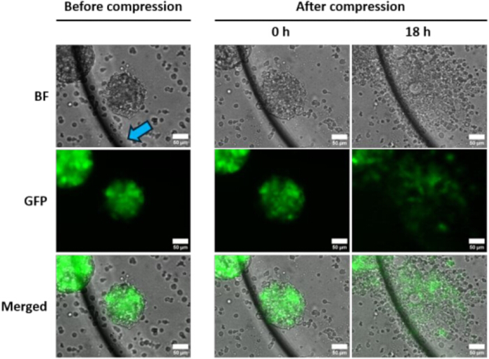 Cell compression effect; BF, GFP fluorescence; before and after; 18h time lapse microscopy results.