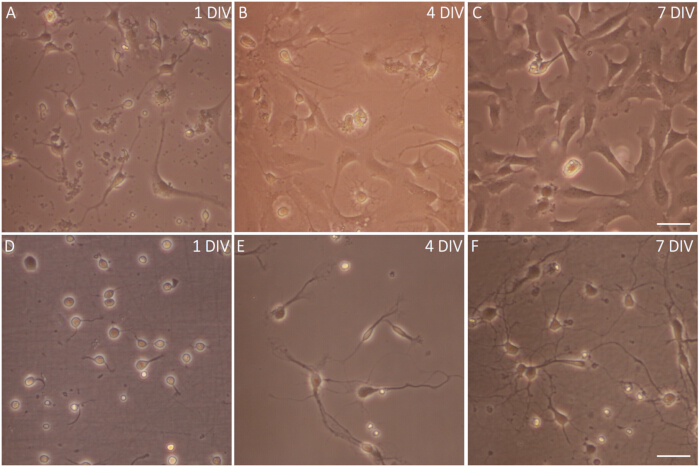 figure-results-3 Cell differentiation in vitro; microscope image showing cell growth from 1 to 7 DIV, six samples.