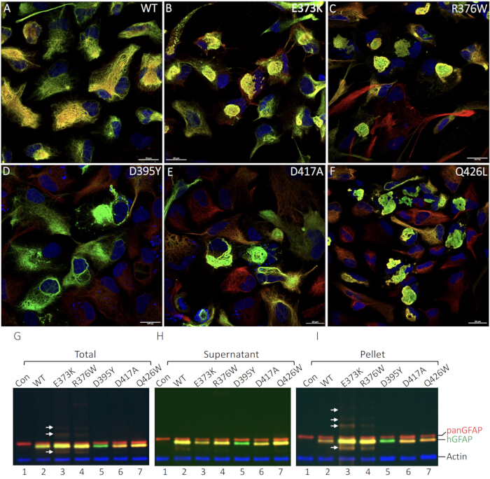 figure-results-4 Cell fluorescence microscopy with genetic variants, protein localization, and immunoblot results.