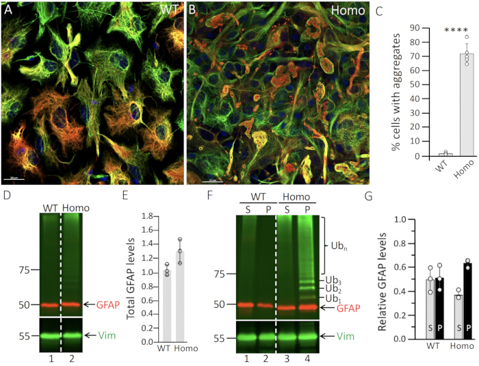 figure-results-5 GFAP immunostaining of WT vs. Homo cells; Electrophoresis results; GFAP, Vimentin protein levels.