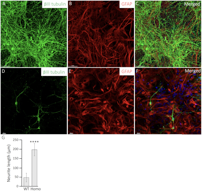 figure-results-6 Neurite outgrowth study; βIII tubulin, GFAP staining; merged images; microscopy and analysis results.