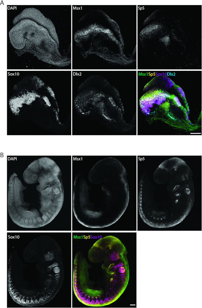 Immunofluorescence staining results, Msx1 Sp5 Sox10 Dlx2 expression, microscopy images.