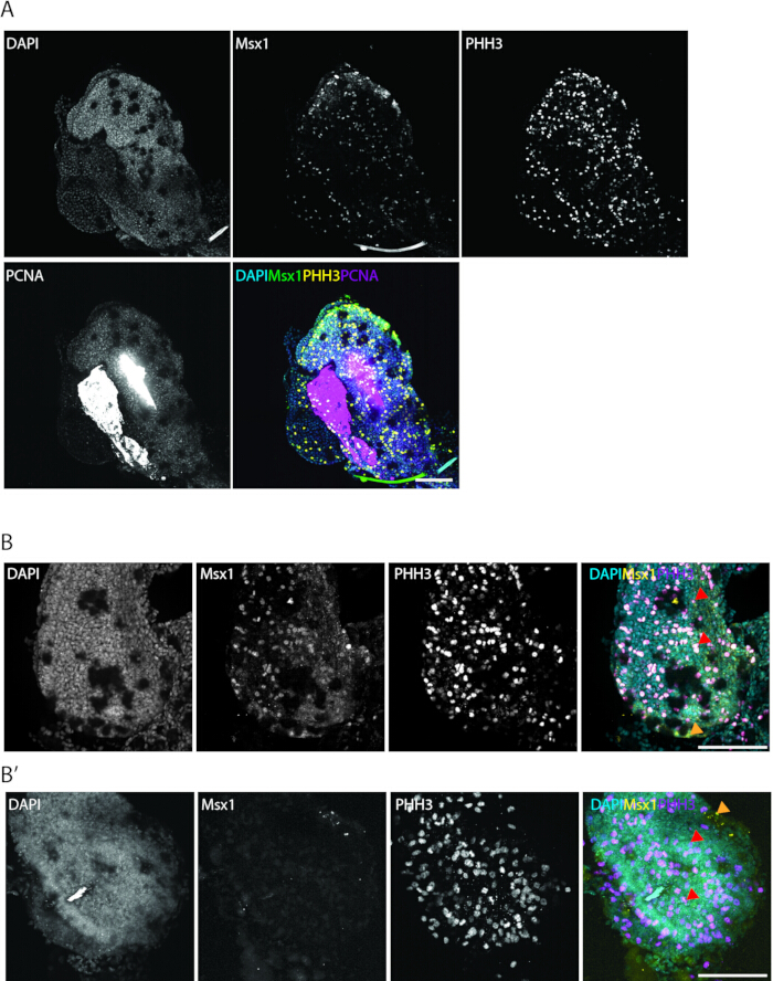 Immunofluorescence microscopy of cell markers (DAPI, Msx1, PHH3, PCNA) showing protein localization.