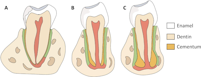 Tooth anatomy diagram: sections showing enamel, dentin, cementum; A, B, C indicate stages.
