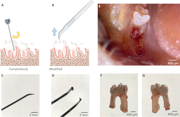 Tooth extraction techniques comparison, diagram and results; conventional and modified methods with extracted roots.
