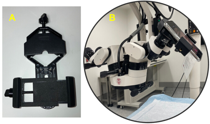Microscopy setup with mounting device and operating microscope for high precision optical study.