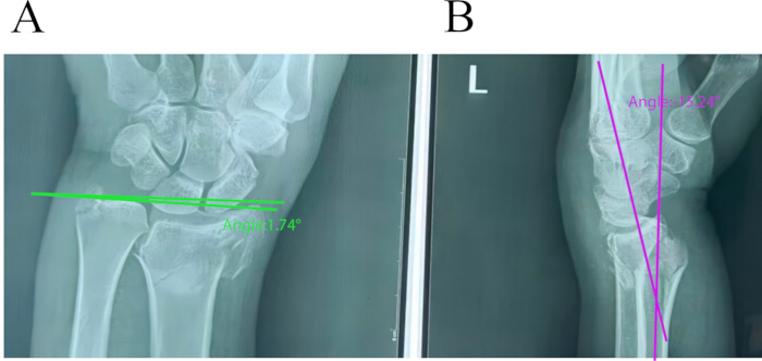 figure-results-1