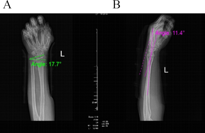 figure-results-2