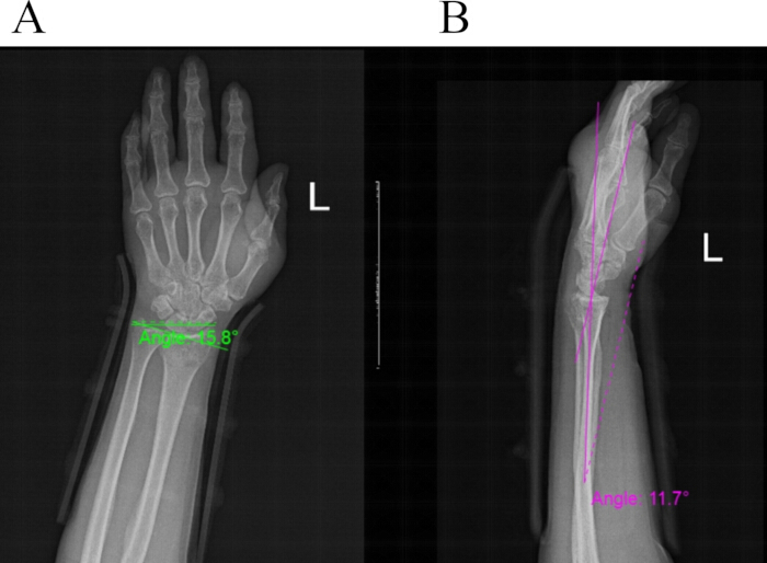 figure-results-3