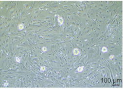 Cell culture microscopy image; fibroblast cells at 100μm scale, cellular growth, cell morphology analysis.
