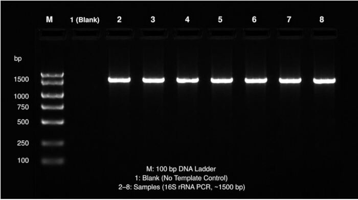 figure-results-1 Gel electrophoresis; 16S rRNA PCR results; DNA ladder; lane separation process analysis.