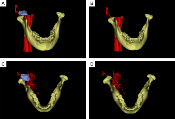 figure-results-4 figure-results-4