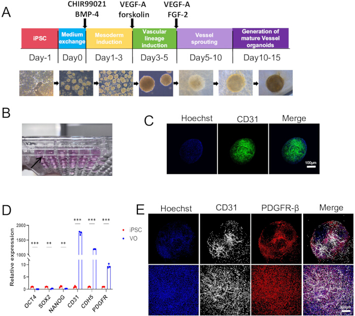 figure-results-1 iPSC to vessel organoids process; differentiation timeline, laboratory setup, expression analysis results.