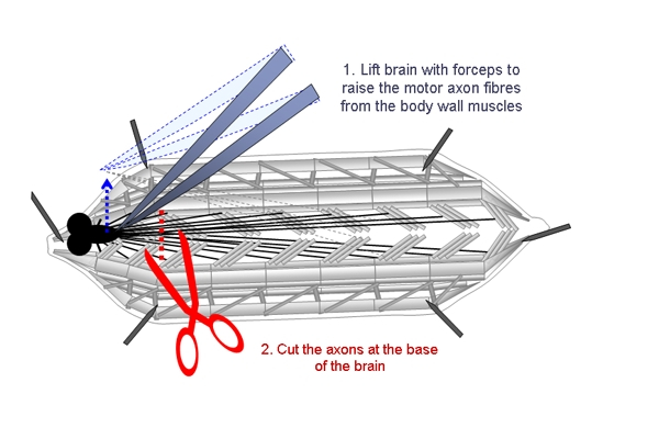 Dissection diagram, lifting brain with forceps, cutting motor axon fibers for neurological study.