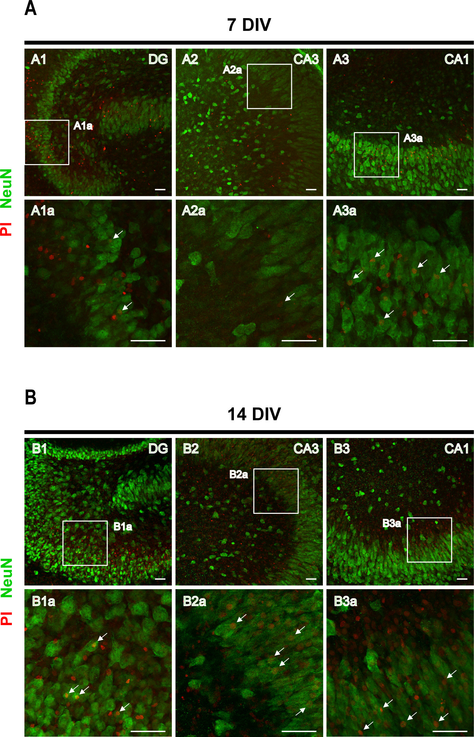 Un modèle d’épileptogenèse dans les cultures de tranches organotypiques ...