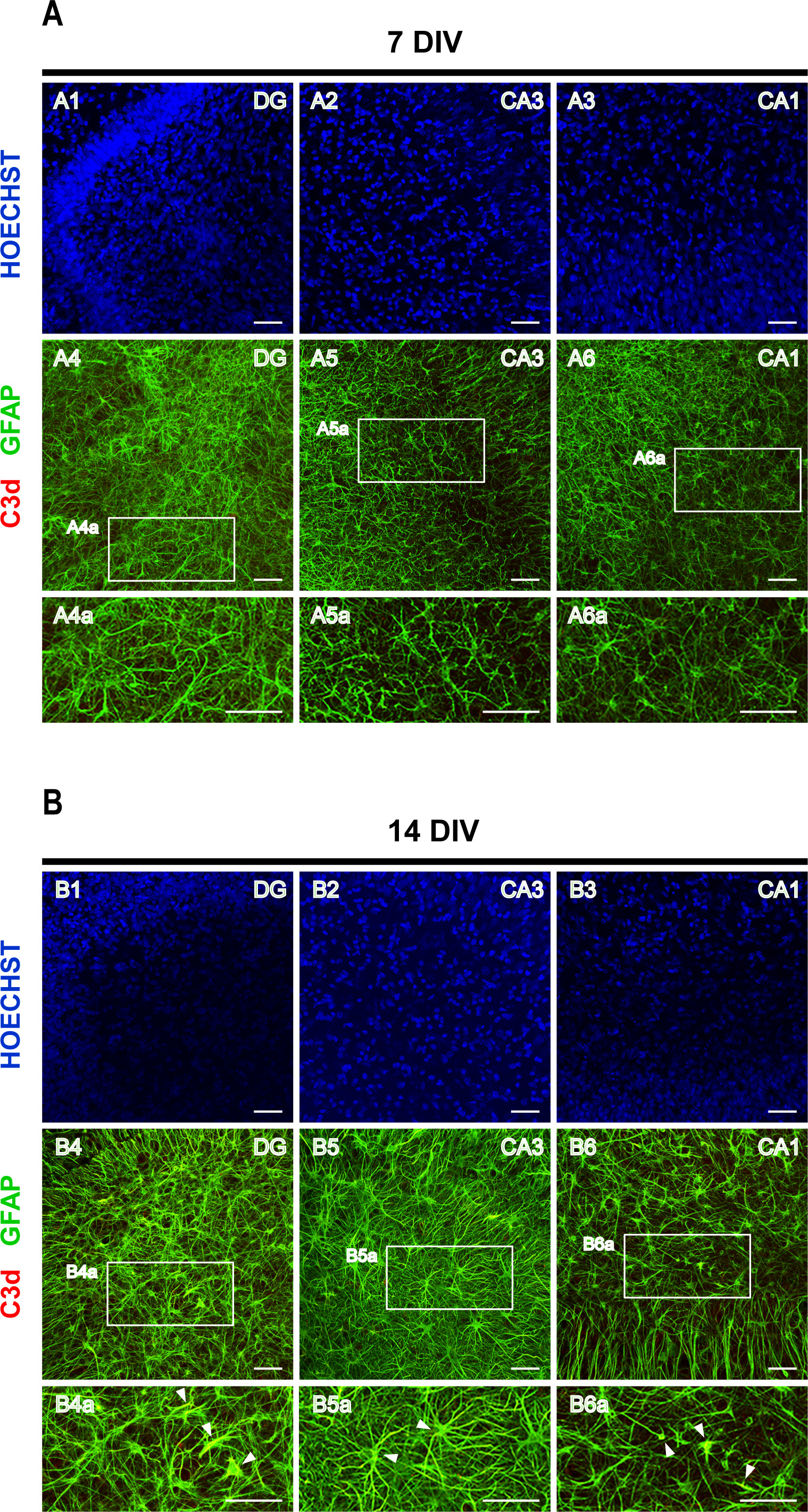 Un modèle d’épileptogenèse dans les cultures de tranches organotypiques ...