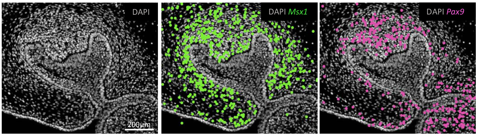 Spatial Transcriptomics of Early Tooth Morphogenesis in Formalin-fixed ...