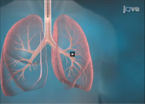 Bronchial Thermoplasty: A Novel Therapeutic Approach to Severe Asthma