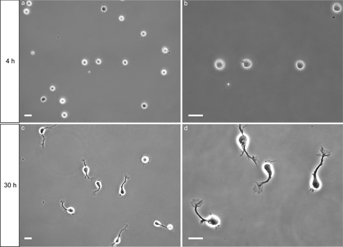 figure-protocol-2 Microscope image, cell growth over time, showing morphology changes at 4h and 30h in experiment.