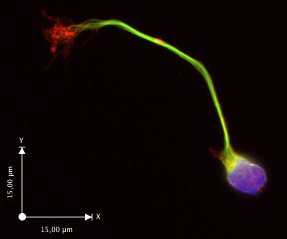 figure-protocol-3 Fluorescent microscopy image, neuron structure, axon and dendrite visualization, scale 15µm.