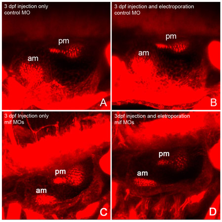 figure-protocol-3 Fluorescence microscopy images comparing zebrafish morpholino injections and electroporation effects.