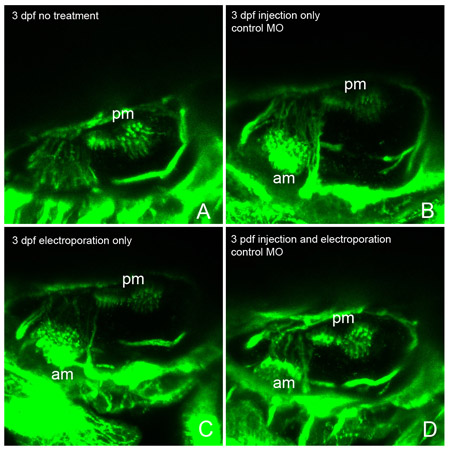 figure-protocol-6 Fluorescence microscopy of zebrafish; comparison of pm and am regions under different treatments.
