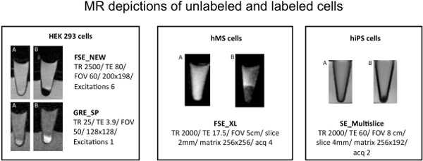 figure-protocol-2 MR imaging of unlabeled and labeled cells; FSE_NEW, GRE_SP, FSE_XL, SE_Multislice; diagrams.