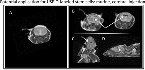 figure-protocol-4 MRI of USPIO-labeled stem cells in murine brain; cerebral injection, transverse and sagittal views.