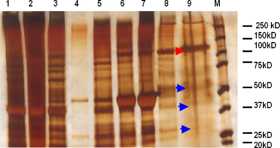 figure-protocol-1 Gel electrophoresis result; protein bands; molecular weight markers; protein separation analysis.