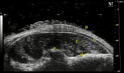 figure-results-10 Optical coherence tomography scan, labeled corneal layers, eye anatomy, medical imaging, cross-section.