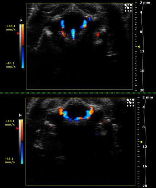 figure-results-18 Doppler ultrasound images showing blood flow velocity in the carotid artery, color-coded analysis.