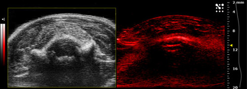 figure-results-19 Ultrasound and photoacoustic imaging comparison; cross-sectional tissue analysis; imaging technique.