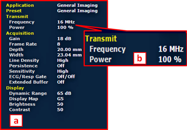 figure-results-3 Ultrasound settings diagram: frequency 16 MHz, power 100%, acquisition display parameters.