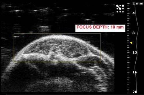 figure-results-5 Ultrasound imaging; tissue cross-section; focus depth at 10mm; medical diagnostic process.