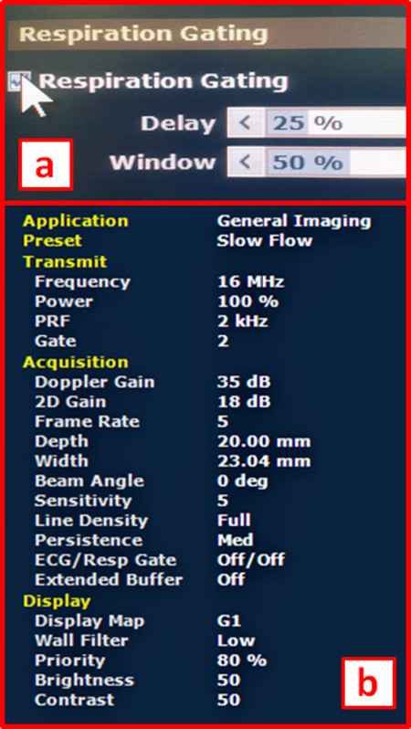 figure-results-6 Respiration gating diagram for ultrasound imaging with Doppler settings and acquisition parameters.