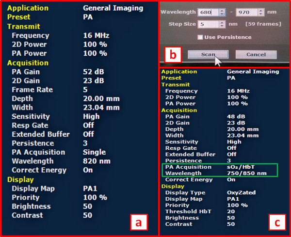 figure-results-8 Ultrasound system setup with parameters for photoacoustic imaging; screen interface & settings.